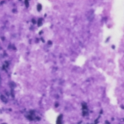 Denoised histology output
